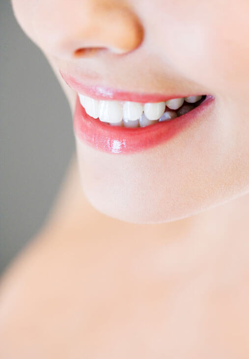 blanchiment dentaire